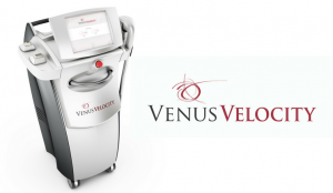 Laser venus online velocity