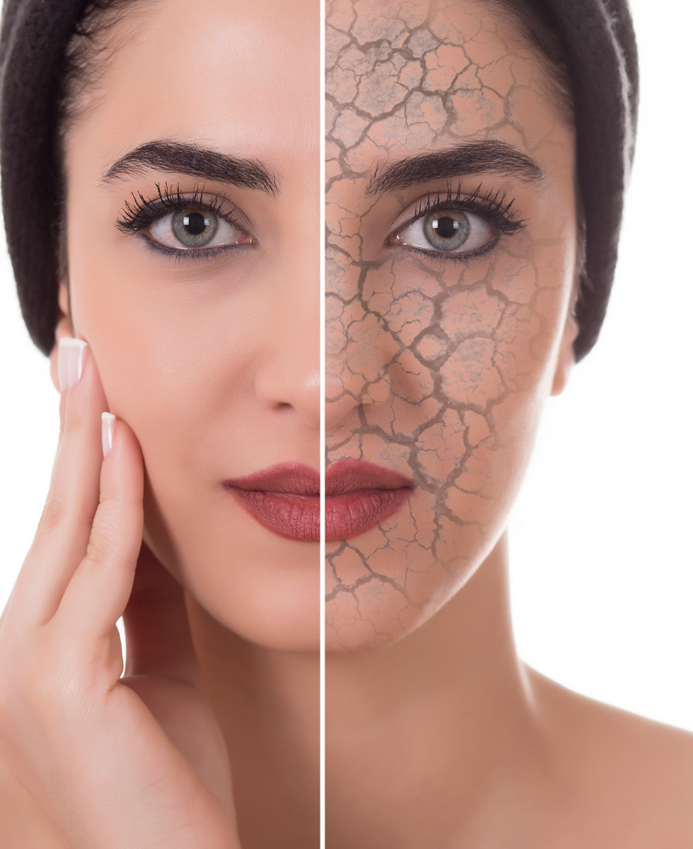 Laser Skin Rejuvenation Balance Clinic